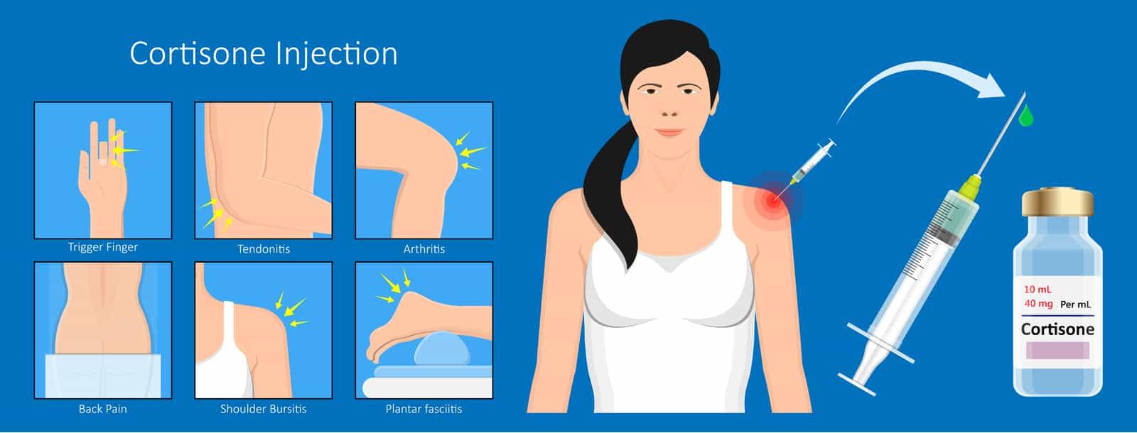 Navigating the Potential Risks and Side ‌Effects of Corticosteroid ⁤Injections